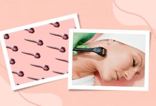 What Is Microneedling? How It Works, Benefits, Risks, and The place to Get It Completed