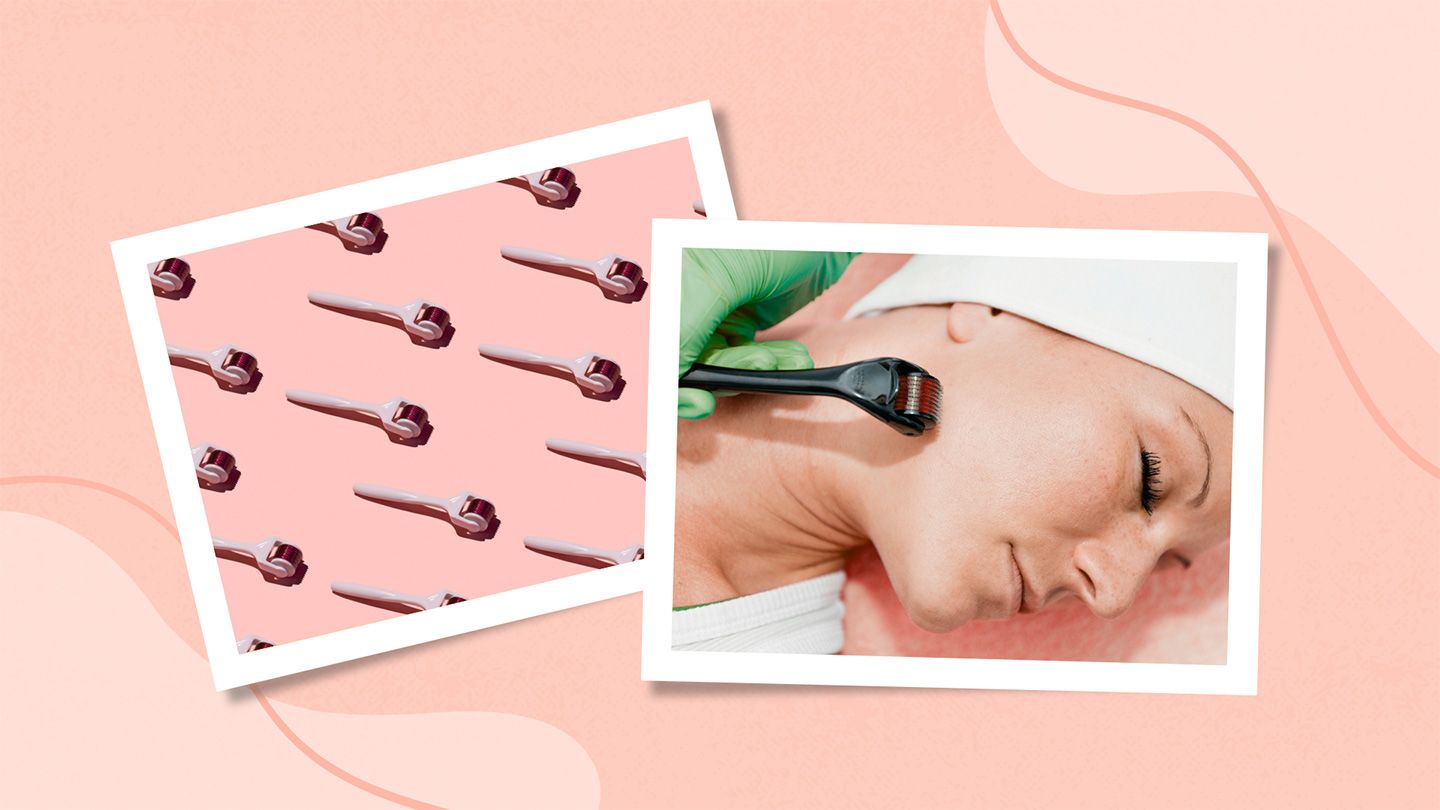 What Is Microneedling? How It Works, Benefits, Risks, and The place to Get It Completed